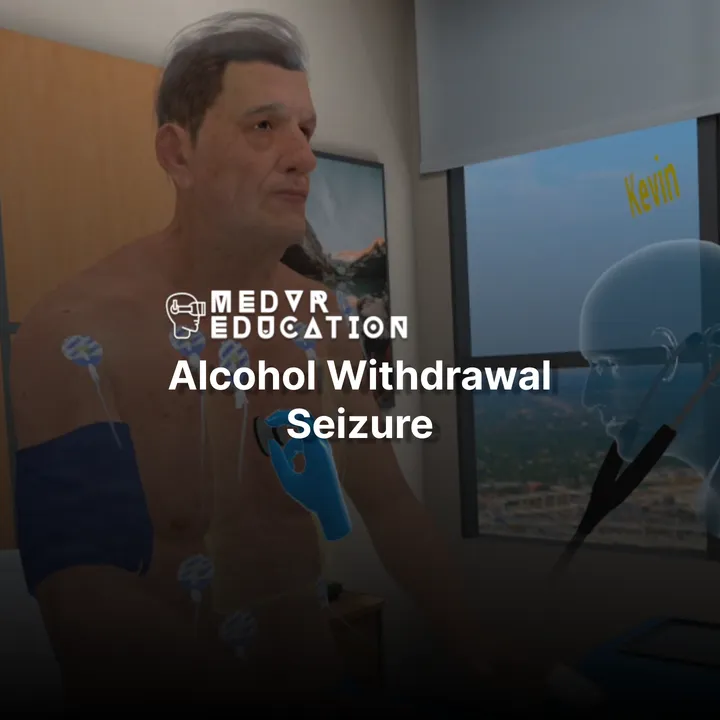 Alcohol Withdrawal Seizure